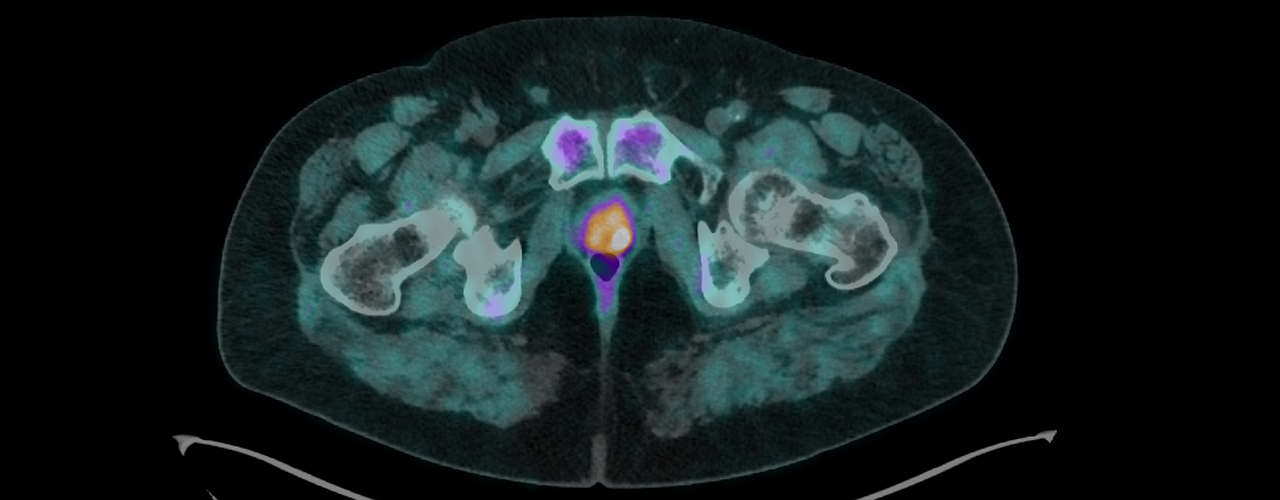 Examen TEP-Scanner